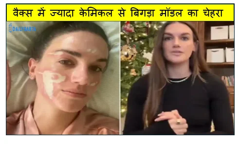 वैक्स में ज्यादा केमिकल से बिगड़ा मॉडल का चेहरा
