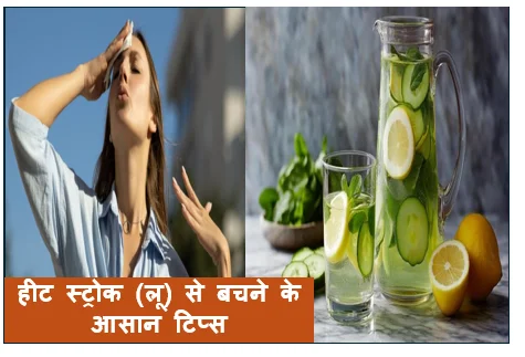 हीट स्ट्रोक (लू) से बचने के आसान टिप्स – गर्मियों में खुद को रखें सुरक्षित
