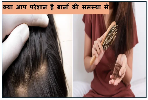 क्या आप परेशान है बालों की समस्या से तो जानिए बालों की देखभाल के लिए बेहद कारगर घरेलू नुस्खे