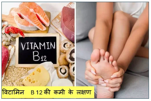 विटामिन  B 12 की कमी के लक्षण कैसे करें विटामिन की कमी को दूर क्या खाएं क्या ना खाएं 